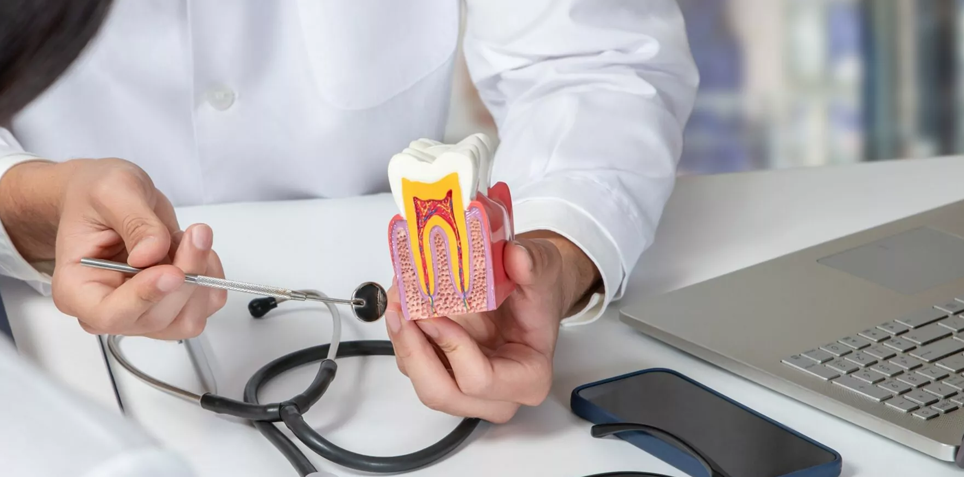 Root Canal in Andheri West