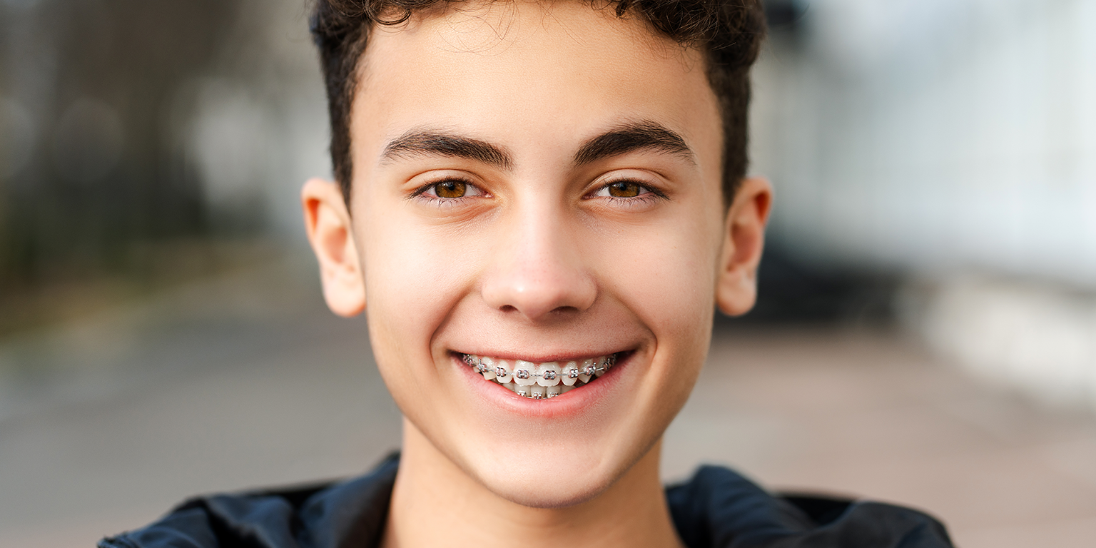 metal braces treatment in Andheri