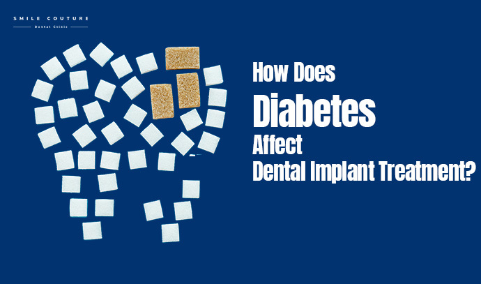 best dental implant in Mumbai