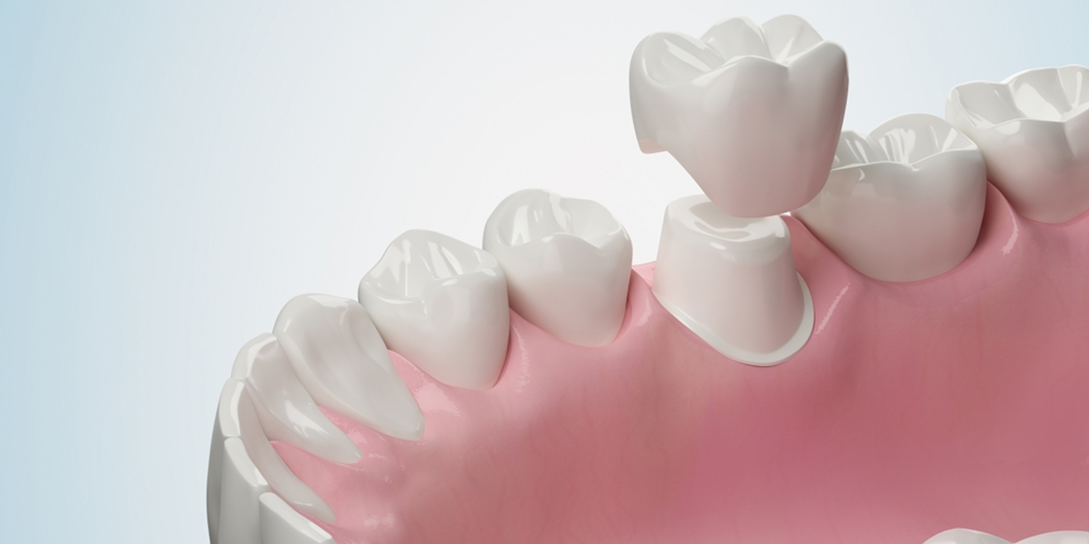 benefits of dental crowns