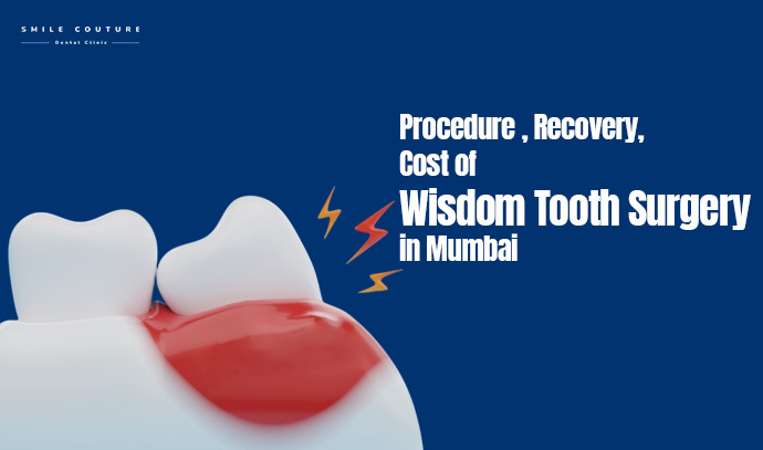 celebrity dentist in Mumbai