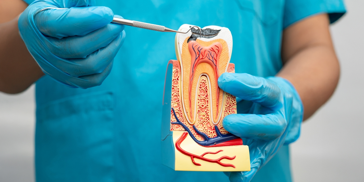root canal treatment