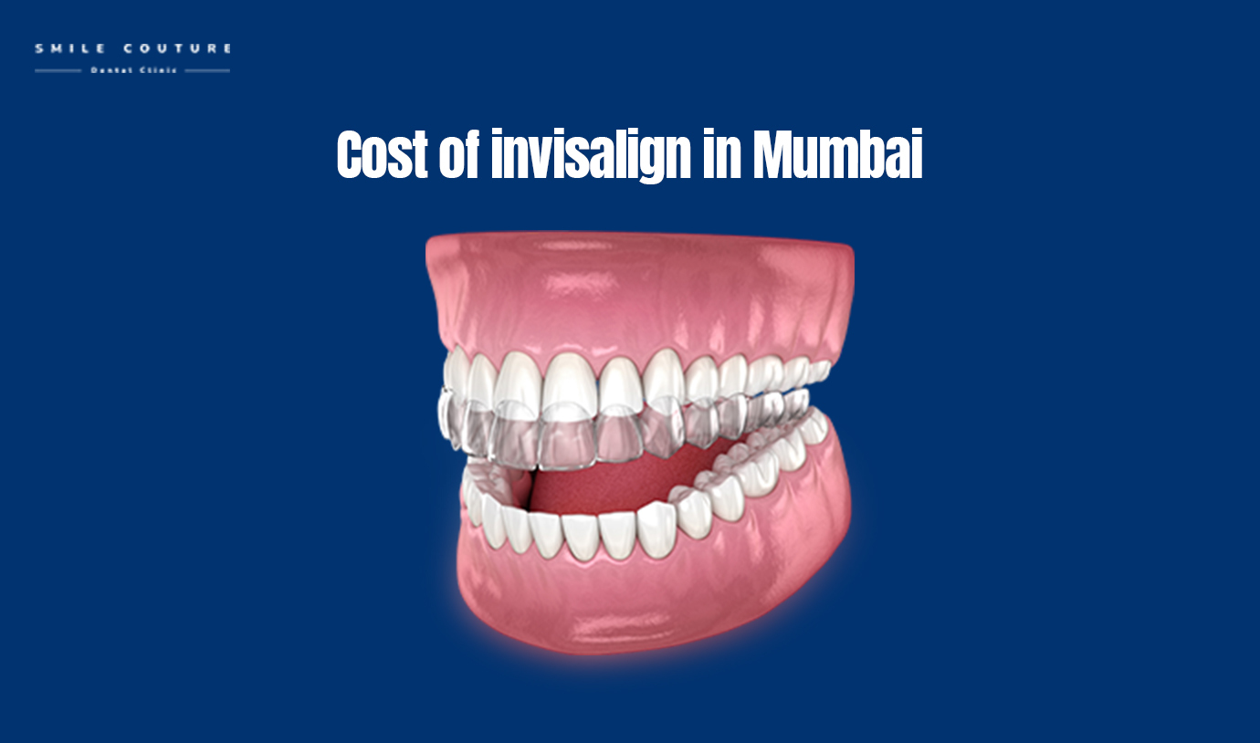 invisalign cost in mumbai