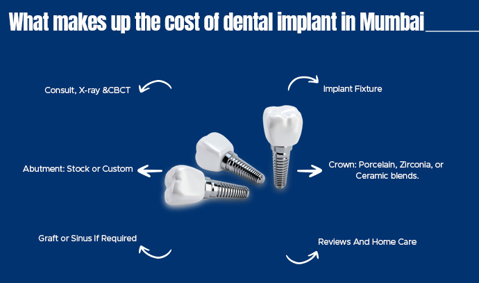 dental implant cost in mumbai