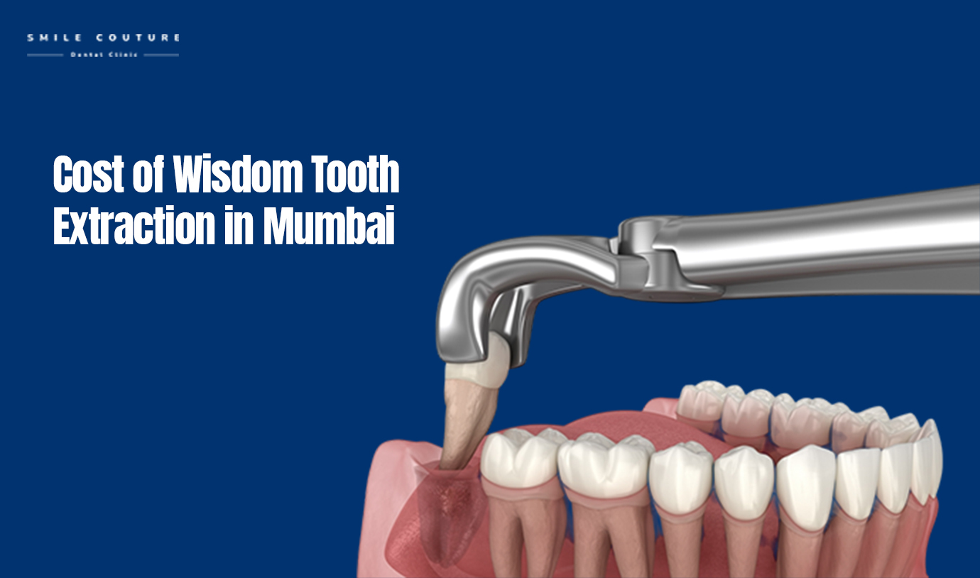 wisdom tooth extraction cost in mumbai
