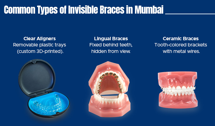invisible braces treatment cost