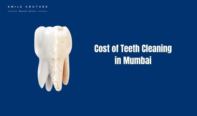 teeth cleaning cost in mumbai