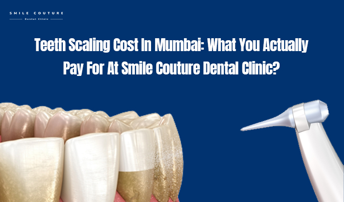 SC banner teeth scaling cost In mumbai