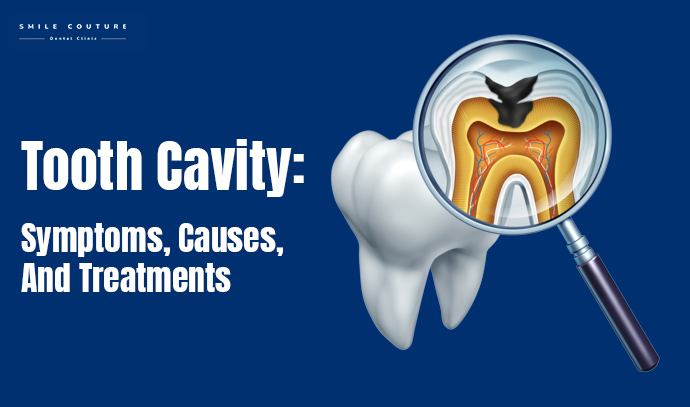 tooth cavity treatment