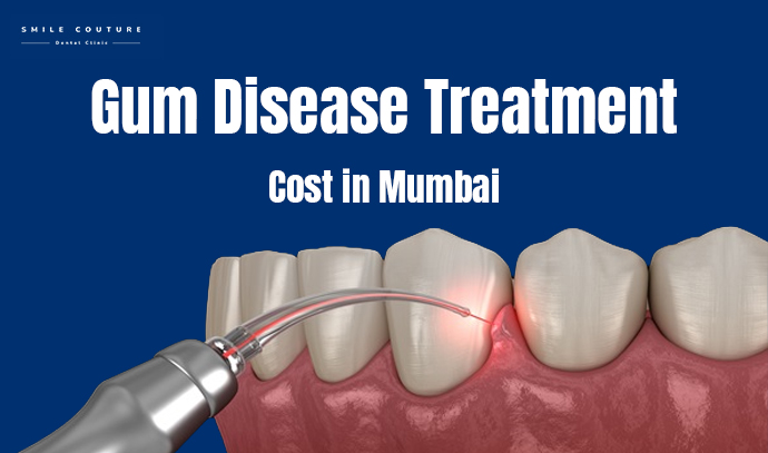 gum-disease-treatment-cost-in-mumbai