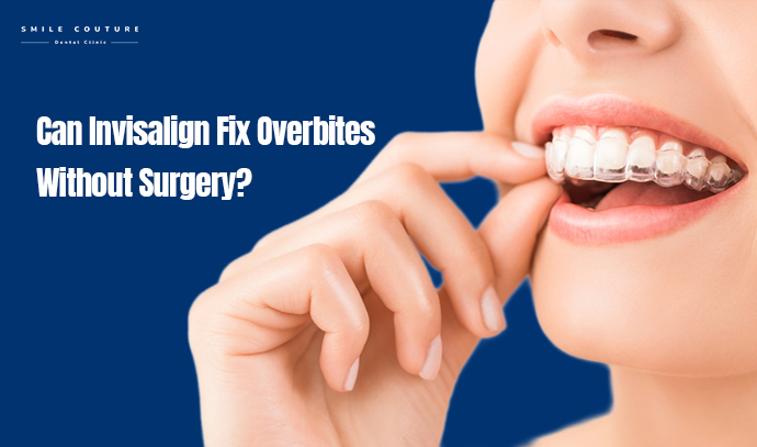 invisalign fix overbites
