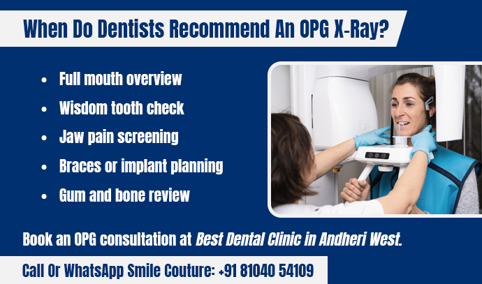 when-do-dentists-recommend-an-OPG-X-ray