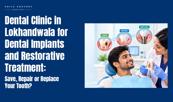 dental clinic in lokhandwala for Dental Implants and Restorative treatment: save, repair or replace your tooth?