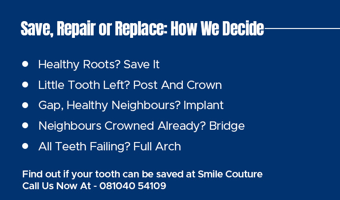 save, repair or replace: how we decide